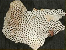 Bryozoans