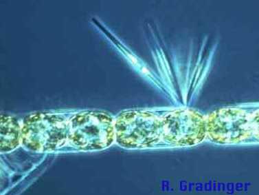 scanning electron image Melosira arctica with ephytic diatoms