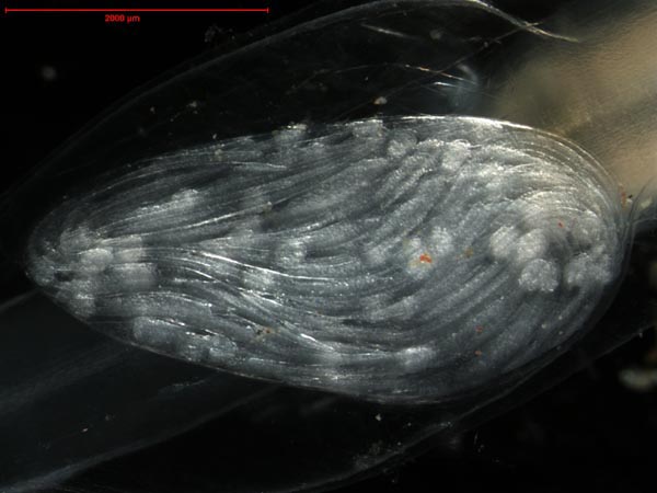 Close-up of a Eukrohnia hamata egg sac