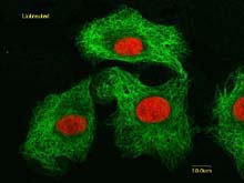 untreated human lung cancer cells