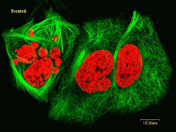 lung cancer cells treated with discodermolide