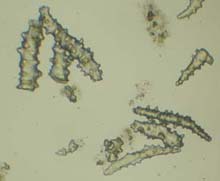 Microscopic spicules from Gorgonacea sp.