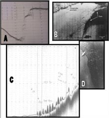 Bottom features observed on the Charleston Bump Figure 2. Bottom features obsserved with sonar and submersible (NR-1) on the Charleston Bump.