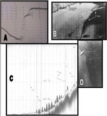 Figure 2. Bottom features obsserved with sonar and submersible (NR-1) on the Charleston Bump.