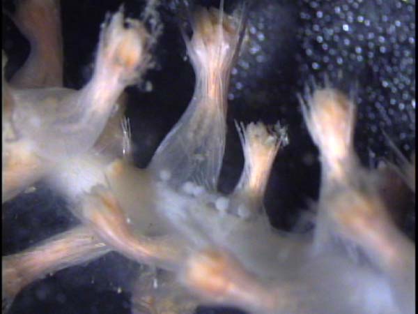 Microscopy of coral polyps with eggs