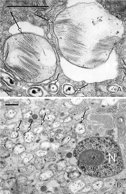 Endosymbionts of Blake Ridge bivalves.