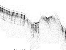 A subseafloor image A subseafloor image of the Gulf of Mexico acquired using a towed acoustic system.