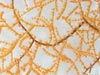 Black coral colony.