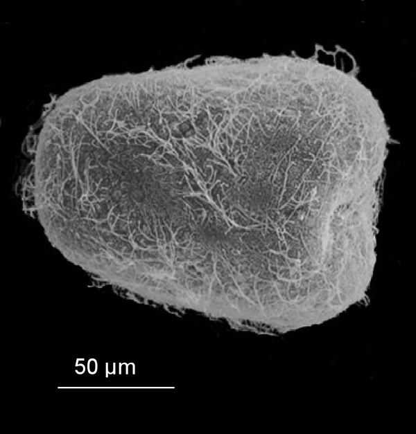 Scanning electron micrograph of 10 day old larva of  Oculina varicosa, a deepwater coral that occurs off the east coast of Florida.