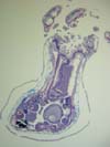 Histological section of Metallogorgia melanotrichos polyp with developing eggs (oocytes).