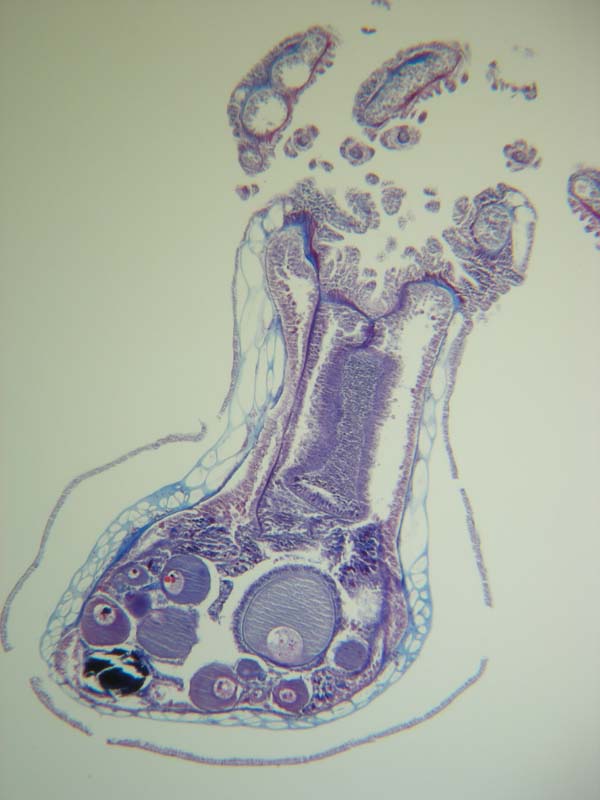 Histological section of Metallogorgia melanotrichos polyp