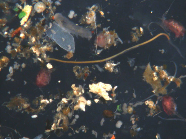 A microscopic image of various meiofauna.