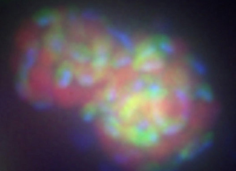 Figure 2a. A cluster of anaerobic methane-consuming archaea (red) and sulfate-reducing bacteria (green). This cluster of cells has been labeled with two ribosomal rRNA probes that target these two specific groups and have fluorescent molecules attached that show up as different colors when viewed with a special microscope.