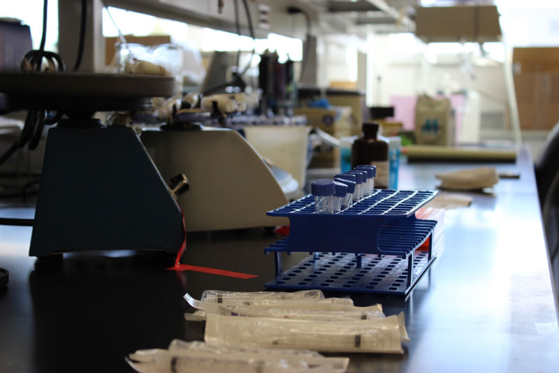 Vortexing microbial cells in cell-releasing solution to remove them from filter membranes (upper left). Awaiting transfer to tubes containing sand-like beads for the lytic process.