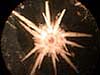 microscopic sea urchin