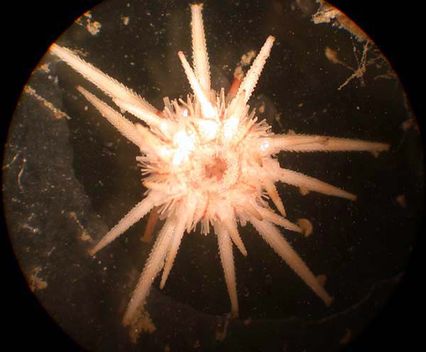 Microscopic sea urchin