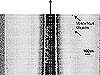 Sidescan sonar