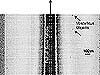 Sidescan sonar