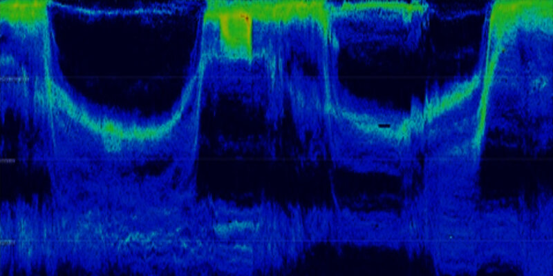 Image from an echogram showing backscatter from the water column from the surface (at the top of the image) to 1,000 meters (bottom of the image) over time (from left to right on the image).  Higher backscatter is shown in green, to yellow and red. Lower levels are in blue and black. The pattern of vertical migration is reflected in the undulating pattern in the high backscatter.
